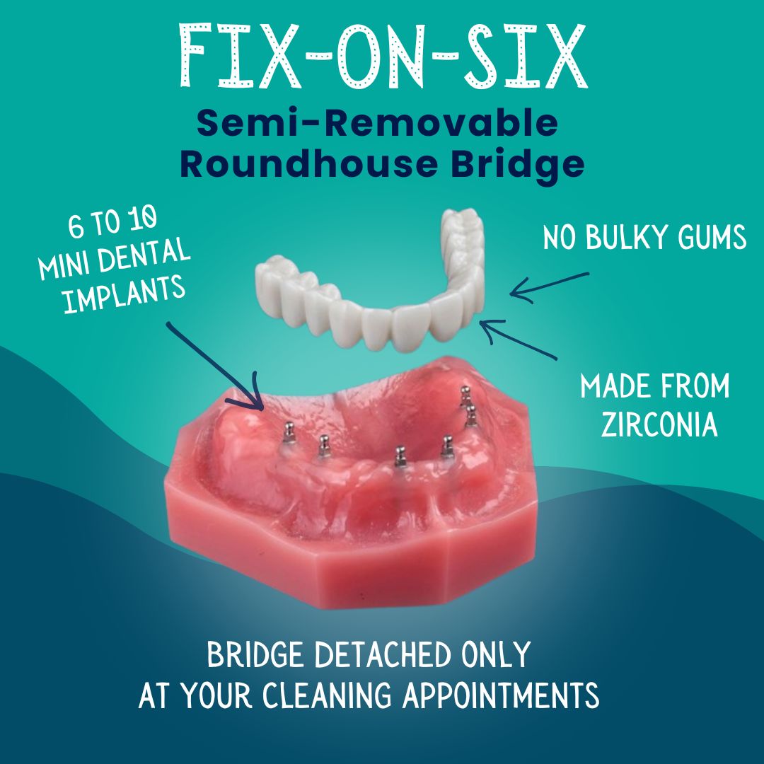 Fix on Six In Springfield, MO