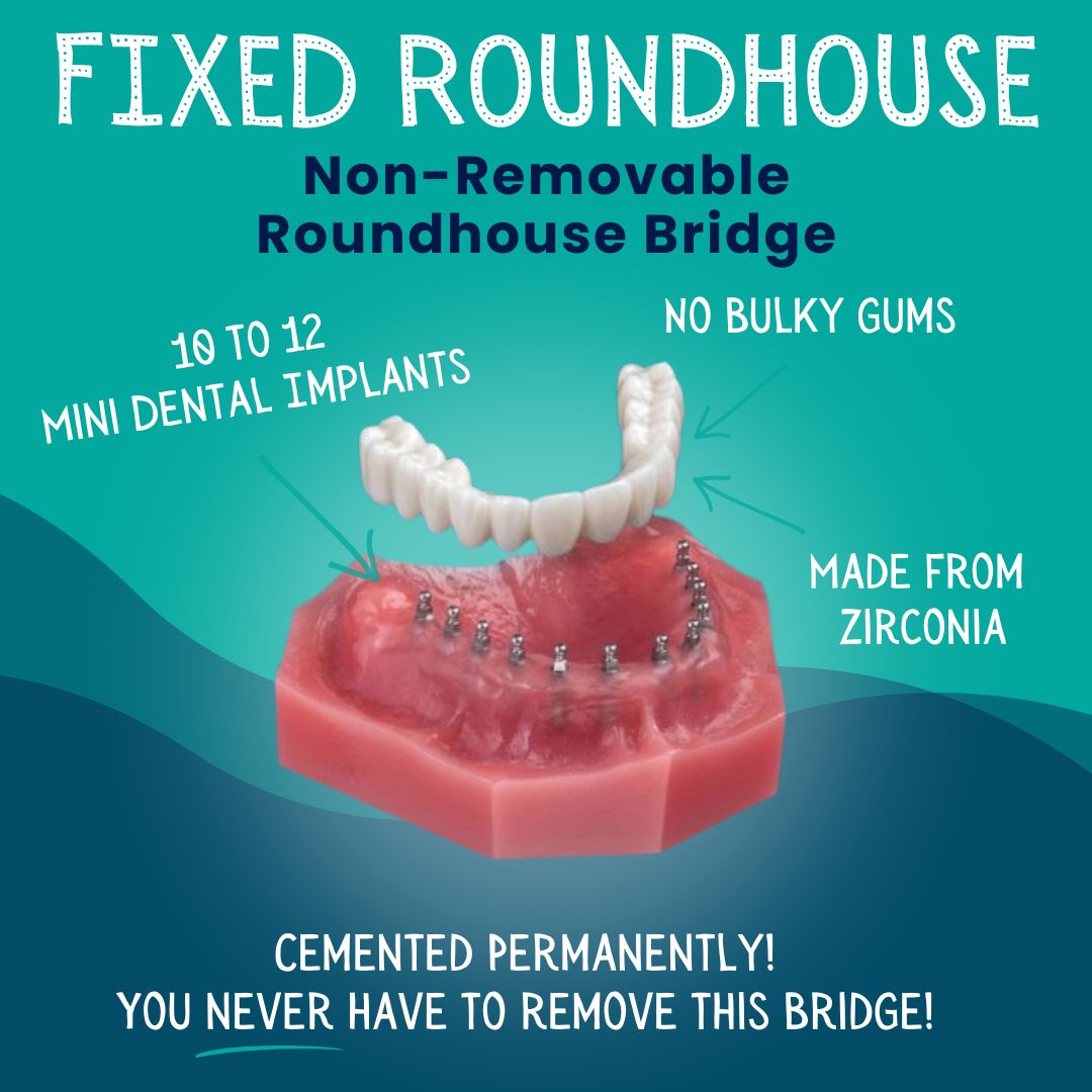 Fixed Roundhouse Bridge in Springfield, MO