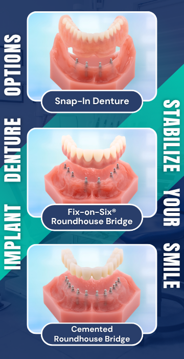 Implant Dentures in Springfield, MO | Denture Alternatives With Mini Implants