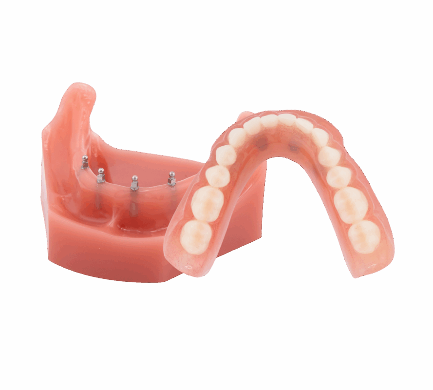 Loose Dentures in Springfield, MI | Book a Free Implant Consult!