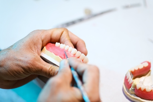 Denture Repair in Springfield, MO | Caring for Your Implant Denture