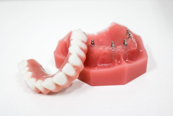 Dentist in Springfield, MO | Secure Your Denture With Dental Implants