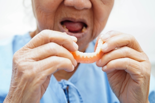 Denture Alternatives [Video Breakdown] Free Implant Consultations
